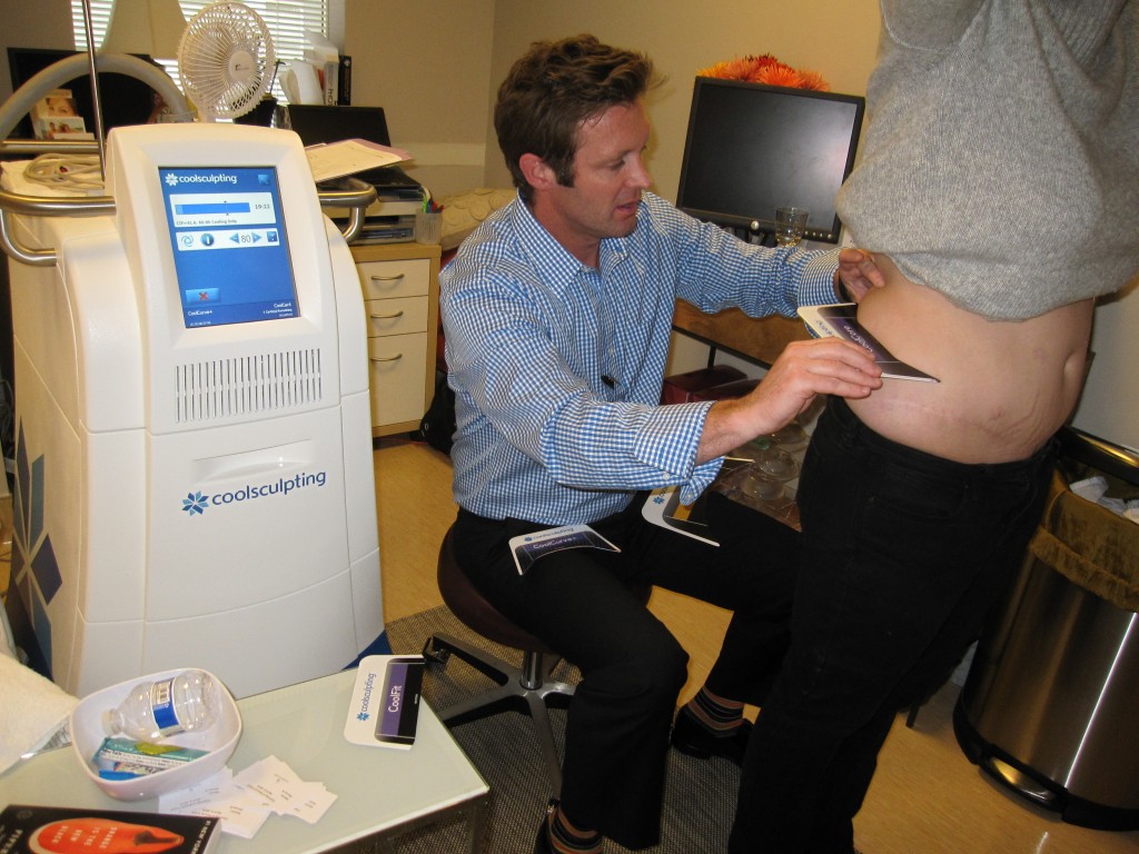 Assessing patients for CoolSculpting at Horton SPA