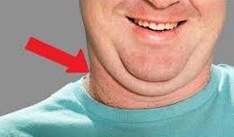 neck fat