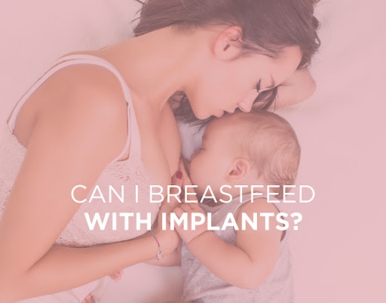 Dr. Horton Discusses Breastfeeding With Implants